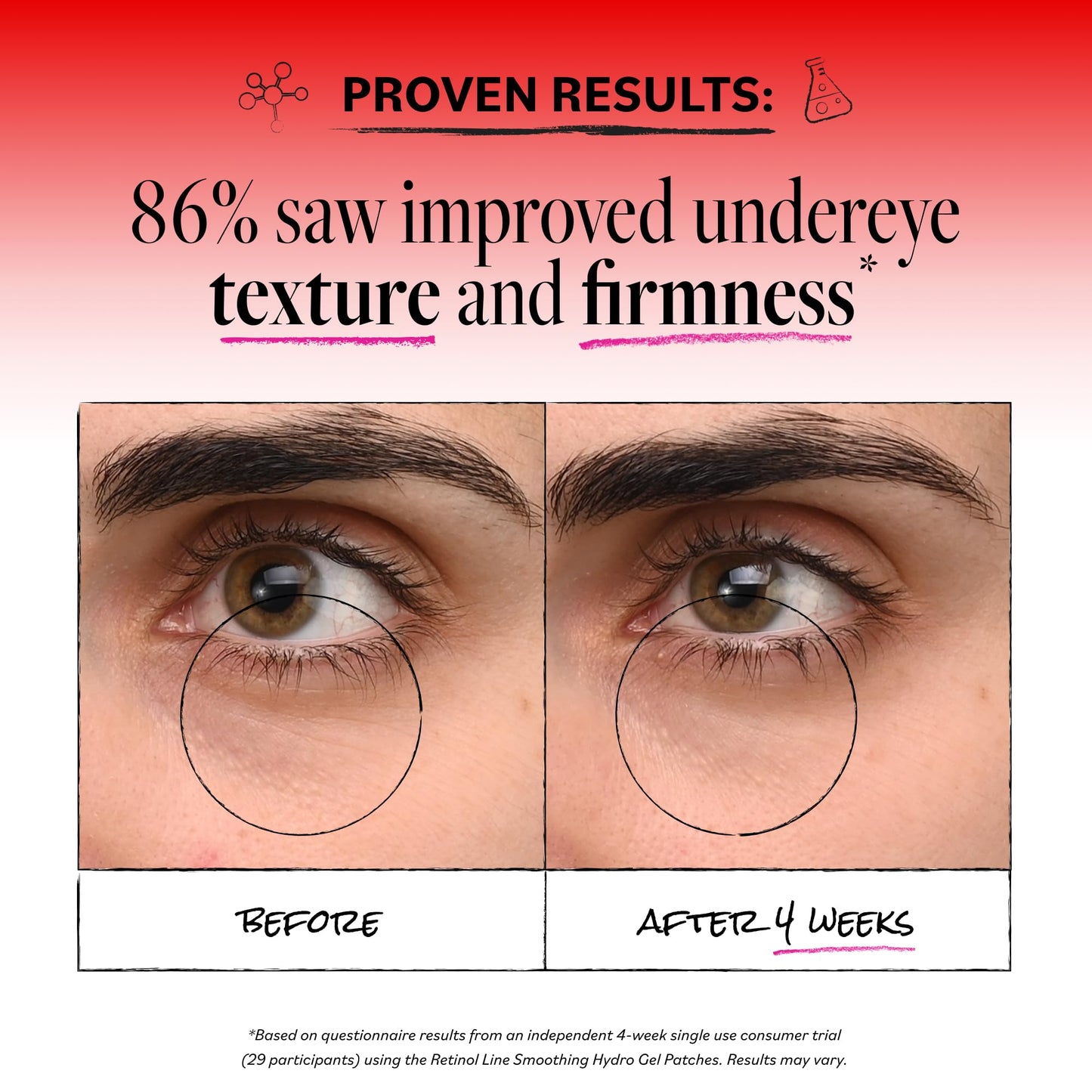 Derma E Retinol + Bakuchiol Under Eye Patches (30 Pairs) Non-Irritating, Line Smoothing Hydro Gel Eye Patches with Rose Water & Real Hibiscus Petals Beauty & Personal Care Derma E