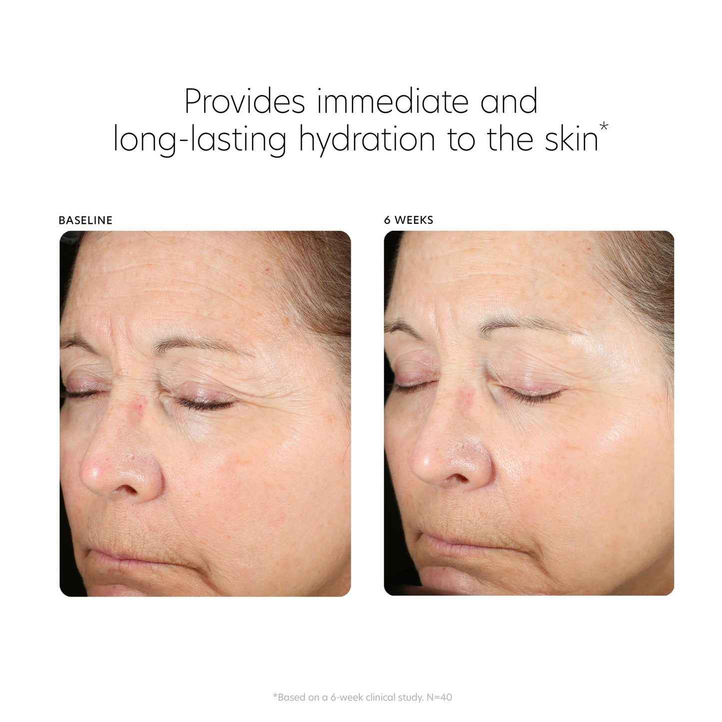 PCA SKIN Hyaluronic Acid Boosting Face Serum, Hyaluronic Acid Serum for Face Made with Niacinamide and Ceramides, Helps Reduce Fine Lines and Wrinkles Beauty & Personal Care PCA SKIN