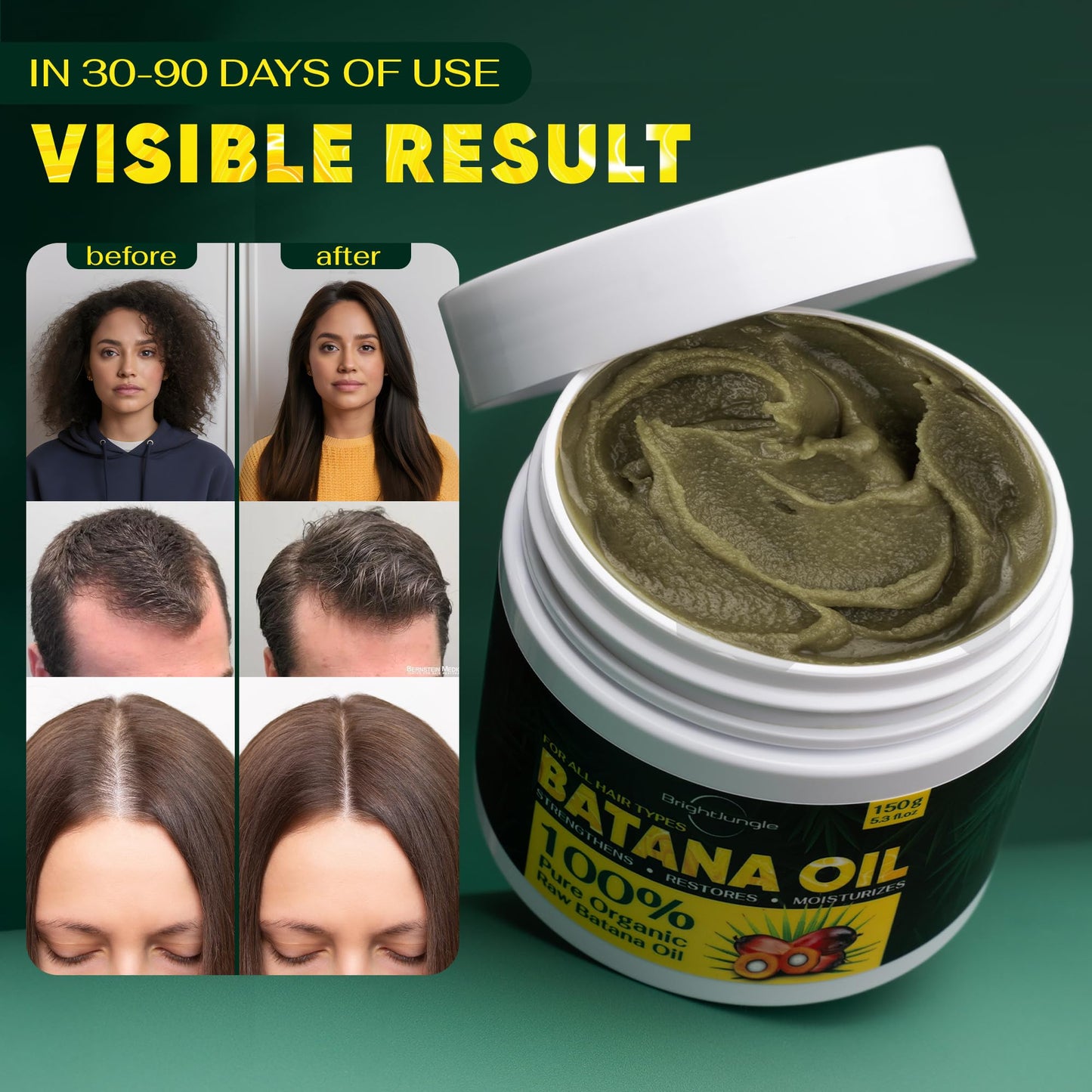 BRIGHTJUNGLE Raw Batana Oil for Hair Growth - Hair & Scalp Oil for Thickness & Shine - Men & Women - 100% Pure, Organic, Cold-Pressed 5.3oz (150g) Beauty & Personal Care BRIGHTJUNGLE