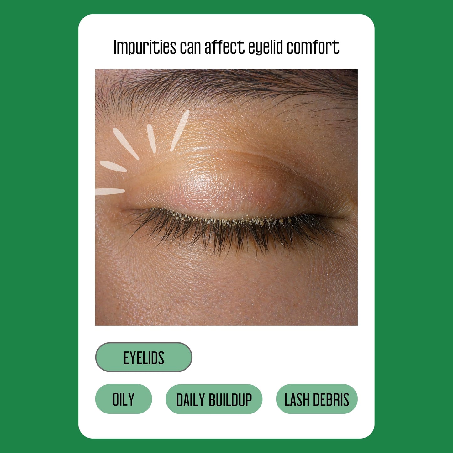 PURELID 100PCs Tea Tree Eyelid Wipes - Cleaning Eye Wipes for People with Dry Eyes & Allergies - Gentle Eyelid Cleanser with Hyaluronic Acid Beauty and Personal Care PURELID