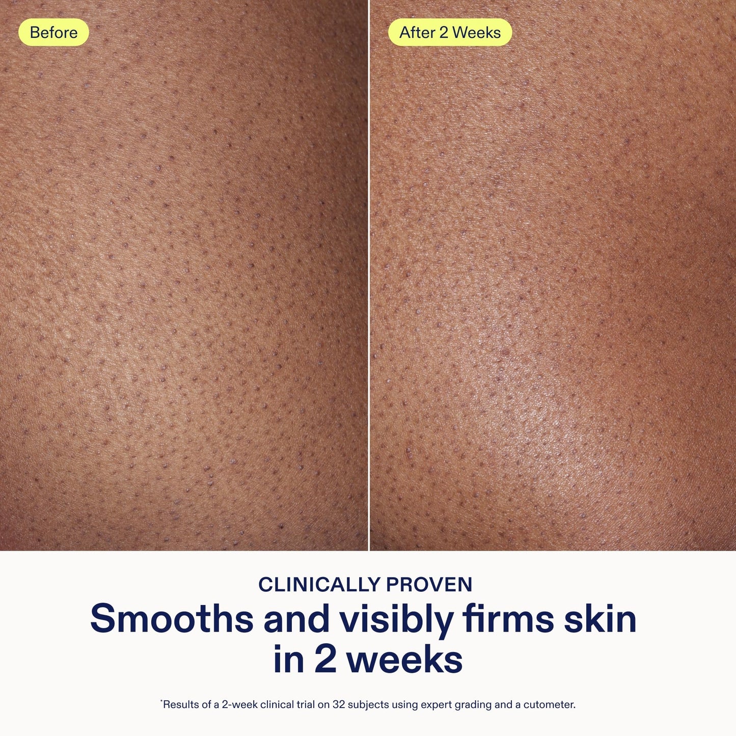 Skinfix AHA/BHA Renewing Body Cream - 10 oz - Skin-Softening Moisturizer with Gentle Exfoliation - Boosts Glow & Radiance - Vegan, Cruelty Free Beauty & Personal Care Skinfix