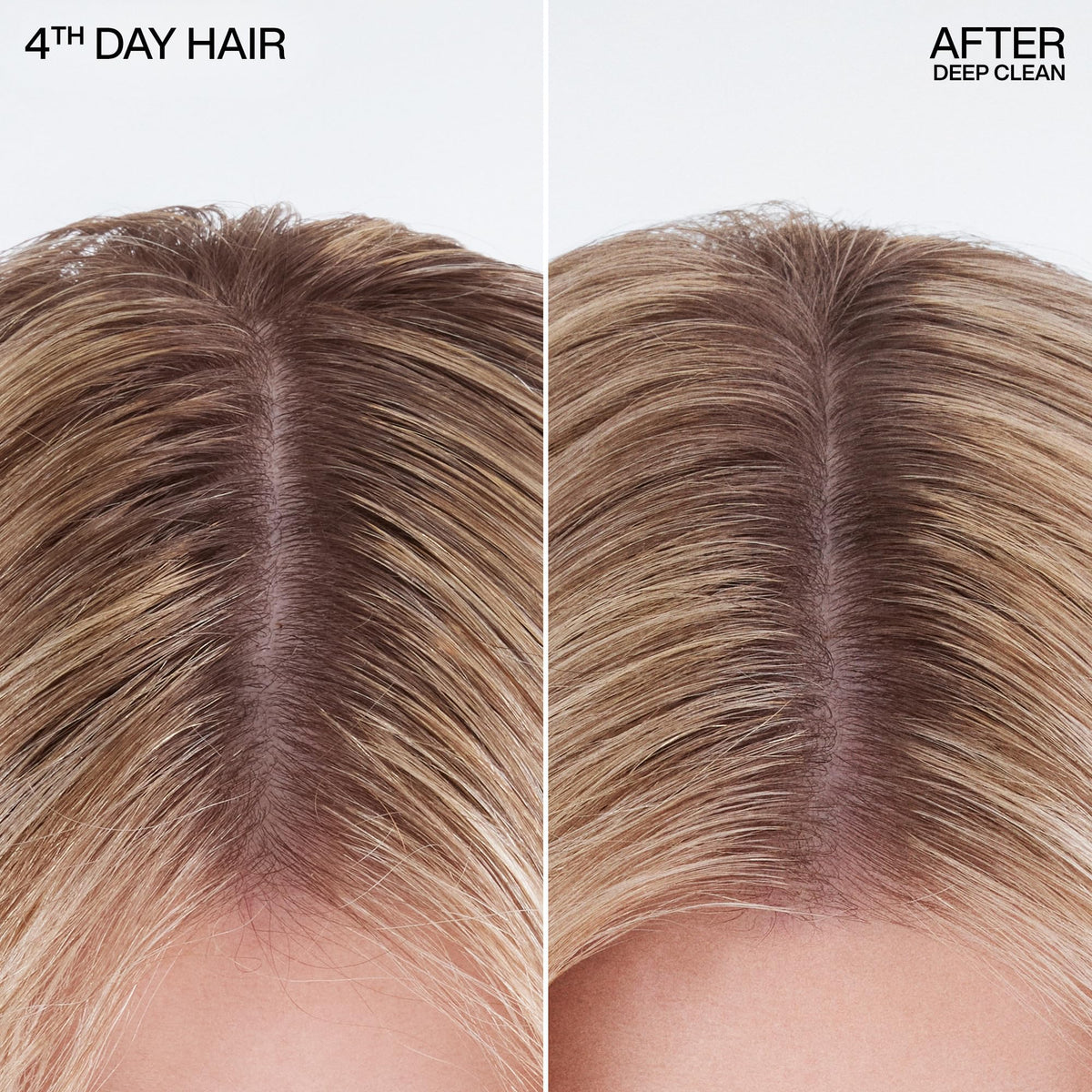 Redken Deep Clean Dry Shampoo - For All Hair Types, 5.2 Oz