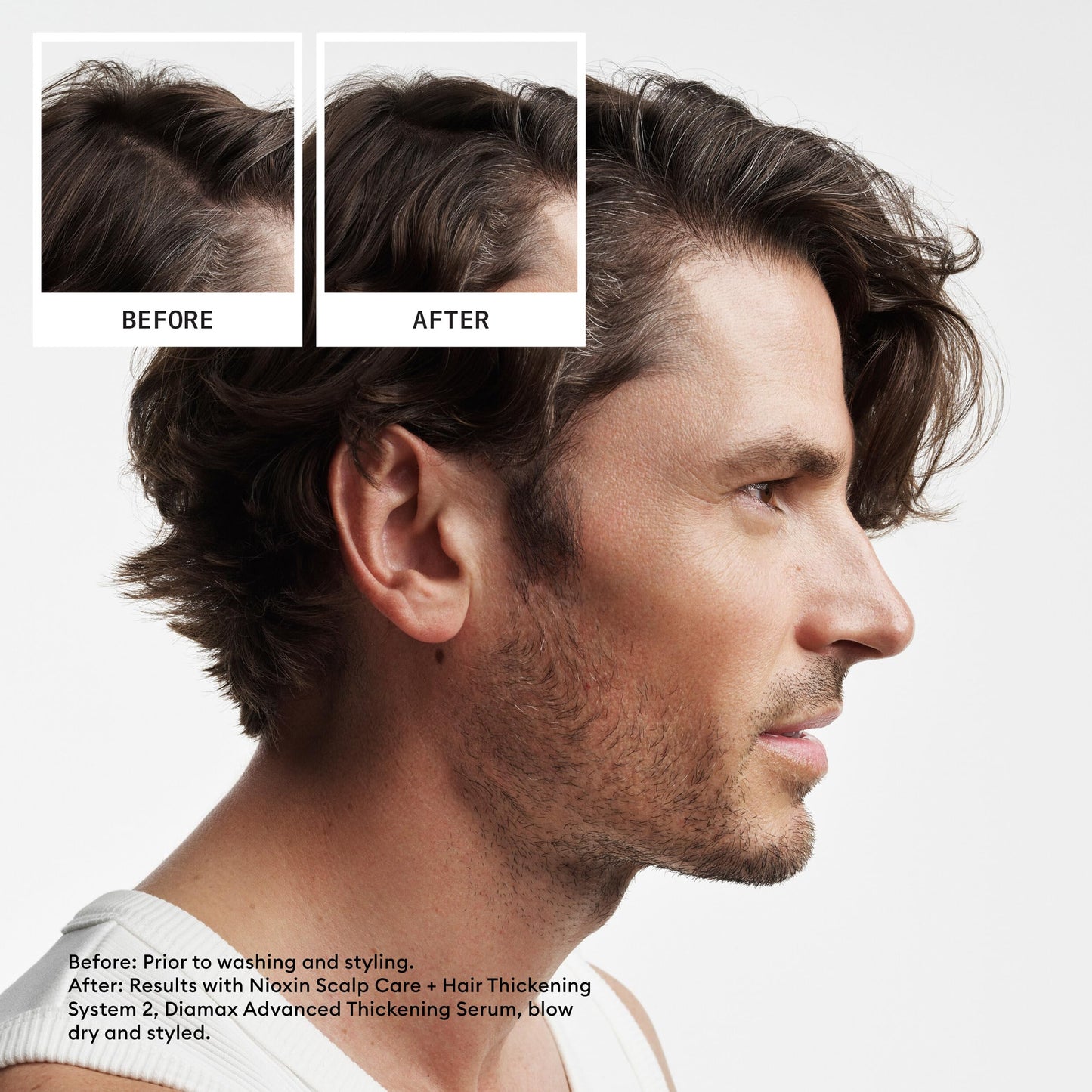 Nioxin Scalp + Hair Thickening System 2 | For Natural or Untreated Hair with Progressed Thinning| Full Size| 3 Month Supply Beauty and Personal Care NIOXIN