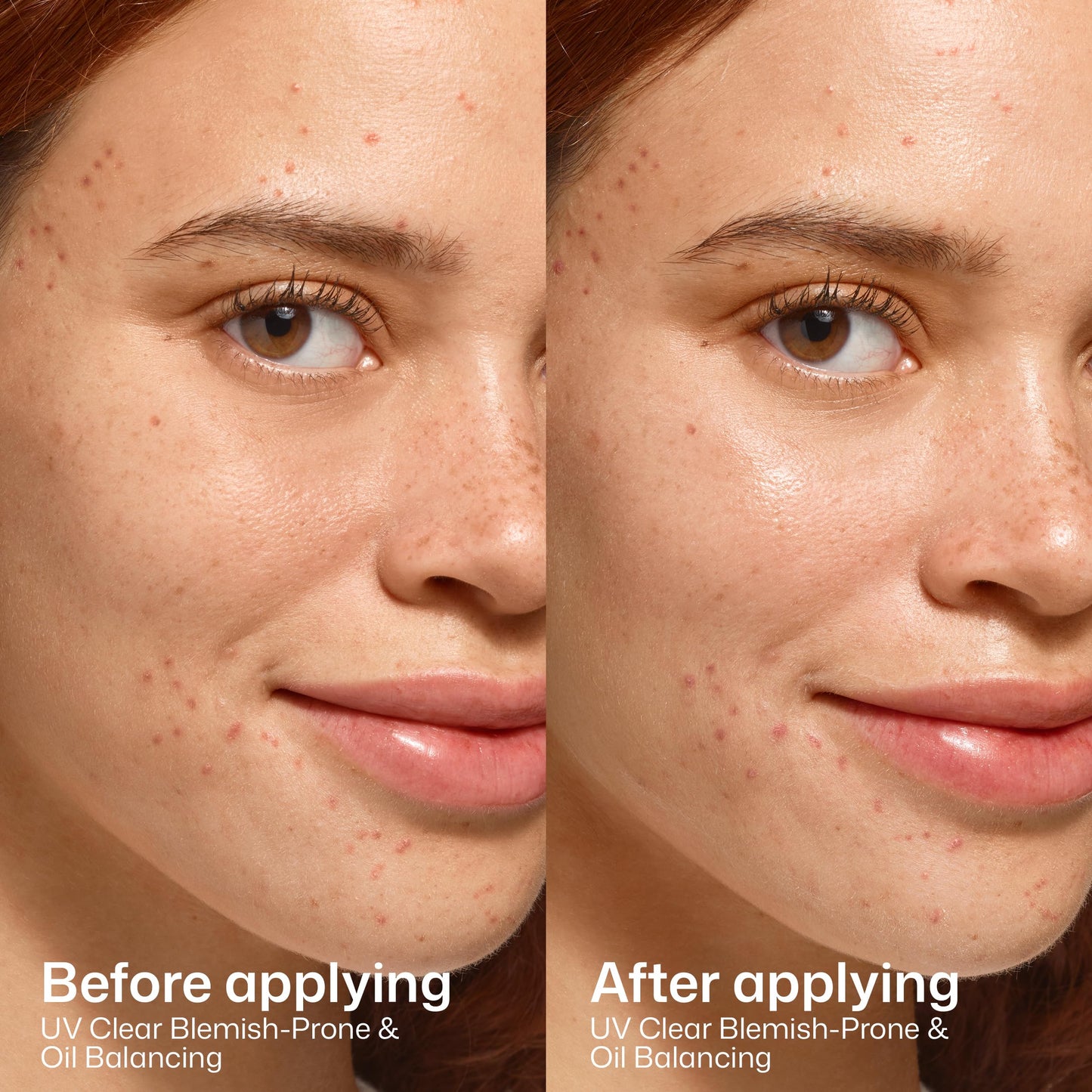 EltaMD UV Clear Blemish-Prone & Oil Balancing SPF 50, Non-Comedogenic Sunscreen with Zinc Oxide, Dermatologist Recommended Beauty & Personal Care EltaMD