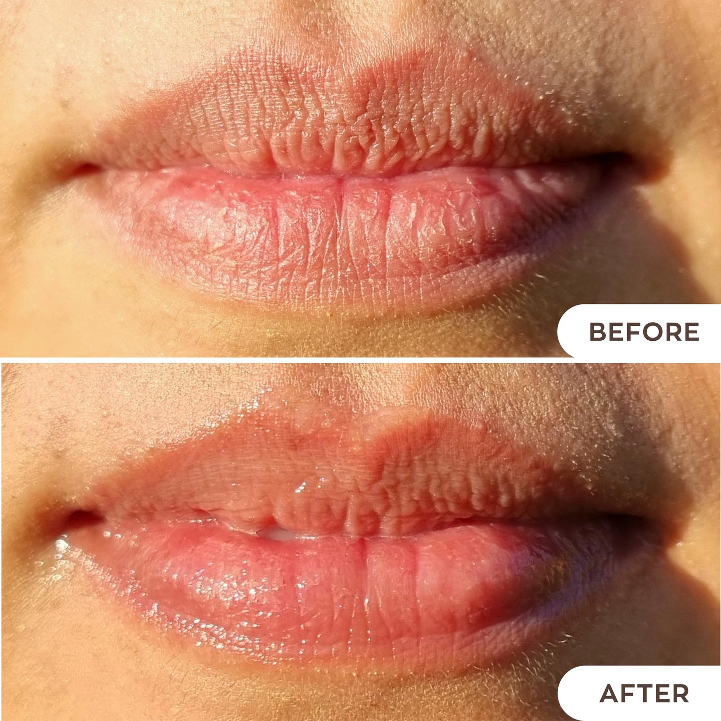 Hanalei Lip Treatment for Dry, Chapped Lips - Intensive Overnight Moisturizer with Kukui Oil, Shea Butter & Grapeseed Oil - Hydrating Balm for Healing Beauty & Personal Care Hanalei