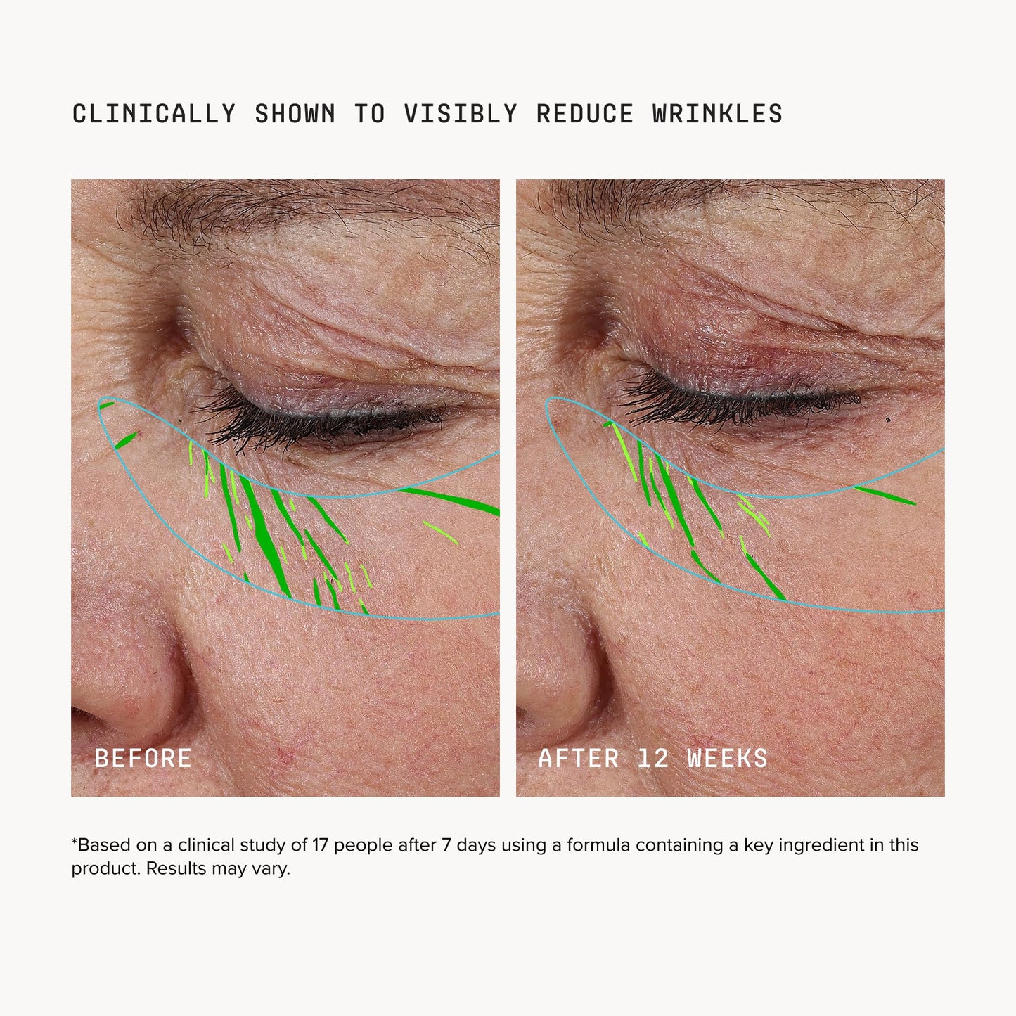DRMTLGY Needle-less Growth Factor Serum for Face - Multi-Peptide & Hyaluronic Acid Facial Serum, Firming & Lifting, Skin Barrier Support & Wrinkle Beauty and Personal Care DRMTLGY