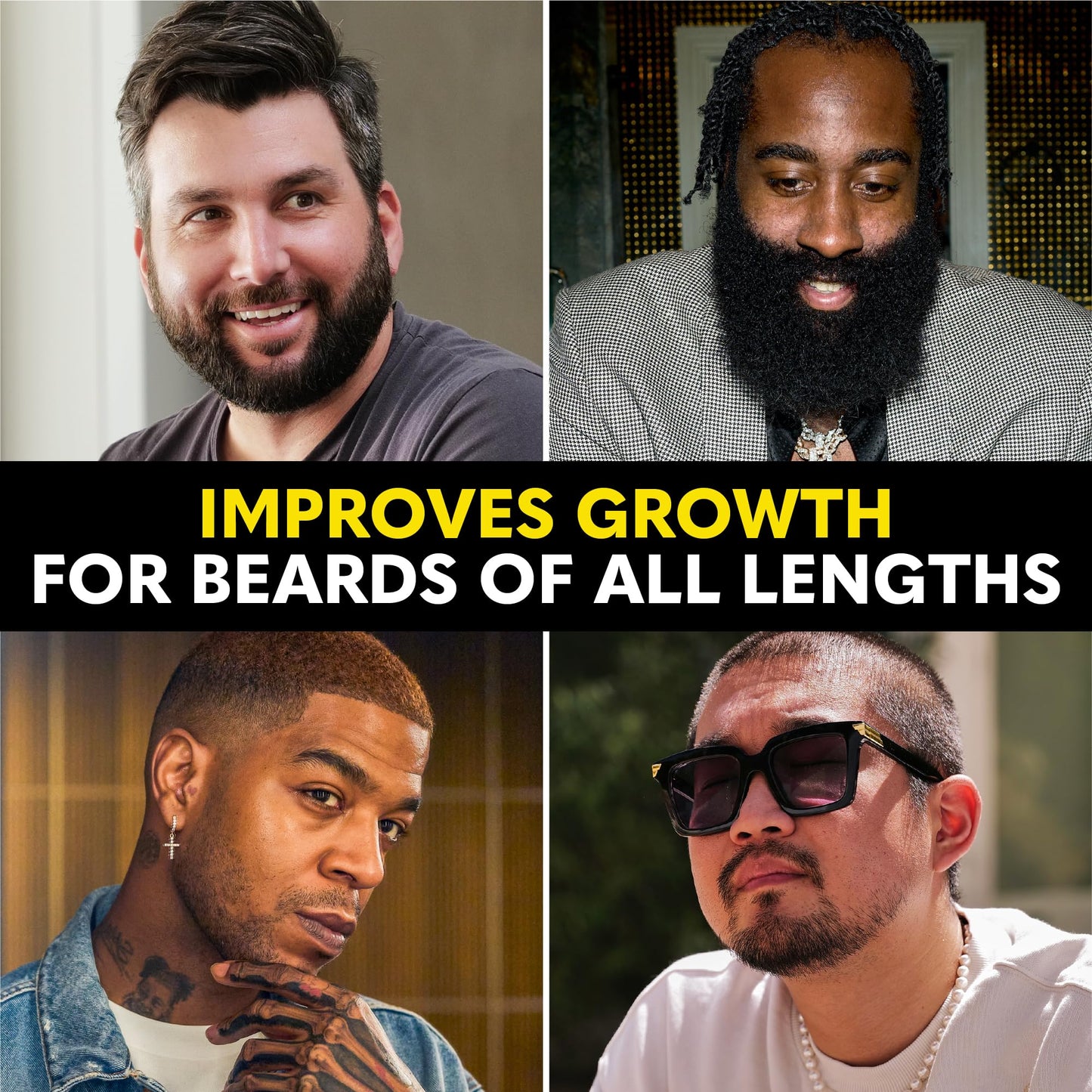 The Beard Club - Beard Growth Oil with Natural Castor & Avocado to Grow Thicker, Fuller Facial Hair, Fill in Patches and Stimulate Healthier Facial Beauty and Personal Care The Beard Club