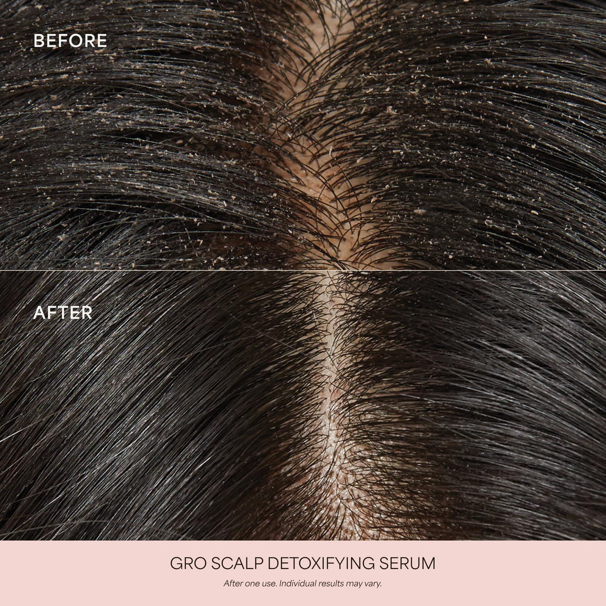 VEGAMOUR GRO Scalp Detoxifying Serum