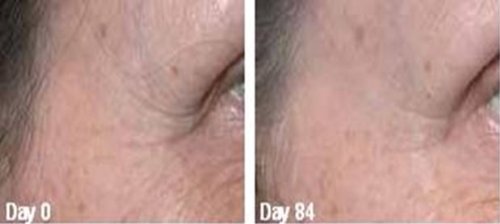 GOLDEN SERUM for Skin tightening, firming and sagging 20% Argireline, DMAE, APT (Red marine Algae), Pepha tight, Hyaluronic acid, Vitamin A (Retinol) Beauty & Personal Care True Radiance