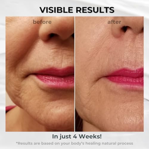 BIONOVA Anti-Aging Upper Lip Treatment with UV Chromophores
