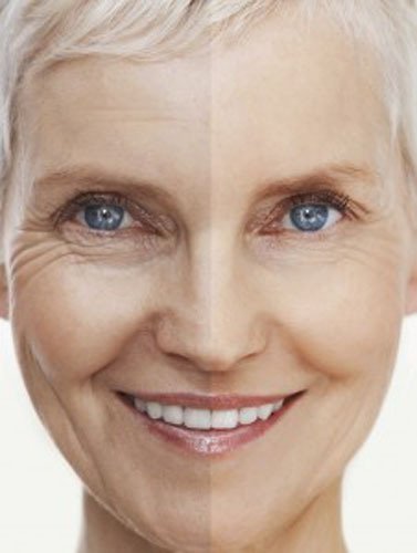 DNA Code®-No Needle Alternative-Pure Argireline Peptides Winkle Reduce Cream-Hyaluronic Acid+ Matrixyl 3000 Beauty & Personal Care DNA CODE Skin Care