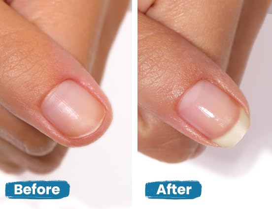 LONDONTOWN Get Strong Nail Hardener - Nail Strengthener Growth Treatment for Damaged Nails, Conditioning Nail Care for Long Healthy Nails, .40fl oz Beauty & Personal Care LONDONTOWN