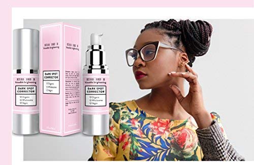 Dark Spot Remover for Face. Dark Spot Corrector Serum Cream for Body, Face, Neck, Hands 1 OZ Beauty & Personal Care KissRedE