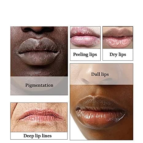 2PCS Natural Plant Lip Balm for Dark Lips,Exfoliating Lip Scrub, Moisturizing Lip Hyaluronic Acid Exfoliating Dead Skin, Lip Balm for Smokers, Restore Beauty & Personal Care LCRORO