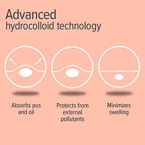 Nu-pore Hydrocolloid Bandages - Pimple Patch Acne and Blemish Patches to Help Blemish Control, 20 Pimple Stickers Per Pack (24 Pack) Beauty & Personal Care nu-pore