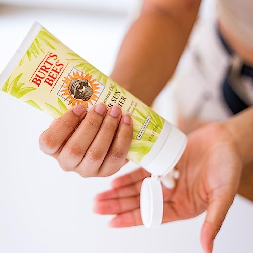 Burt's Bees After Sun Lotion with Hydrating Aloe Vera & Coconut Oil - Summer Essentials, Sunburn Relief, Natural After Sun Soother, 6 oz Beauty & Personal Care Burt's Bees