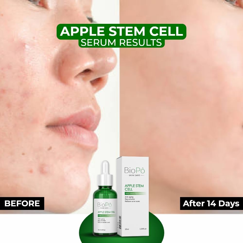 Apple Stem Cell Anti Aging Serum, Rejuvenates Skin, Reduces Acne Scars, Diminishes Fine Lines and Wrinkles, Hydrates Skin, For Radiant and Youthful Beauty & Personal Care BioPo
