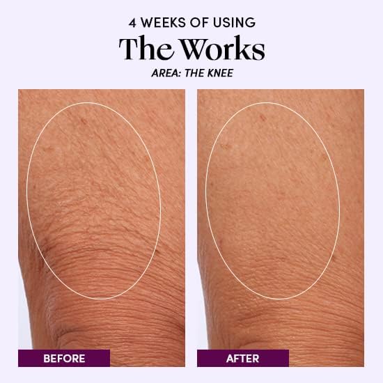 Womaness The Works All-Over Toning Body Cream - Hydrating & Smoothing Firming Body Lotion - Anti Aging Skin Tightening Cream for Body with Niacinamide Beauty & Personal Care Womaness