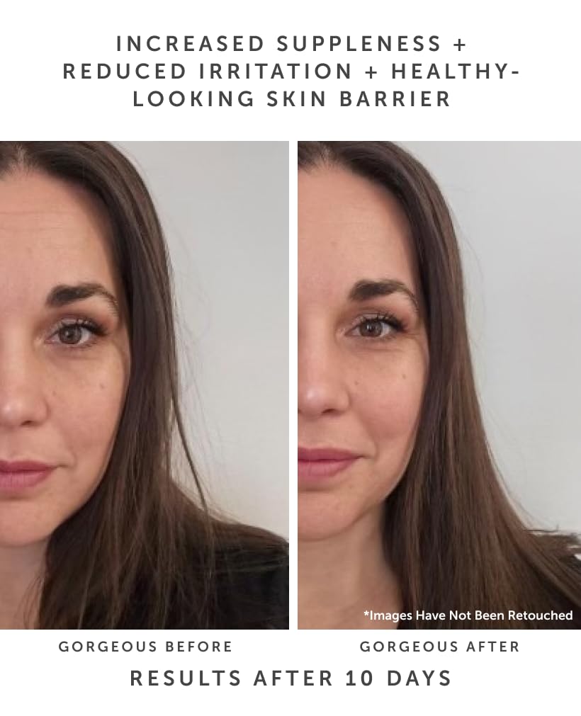Earth Harbor | HORIZON Ceramide Recovery Serum - Skin Barrier + Hydration | Phytosterols + Blue Lotus + Beta Glucan | 20 ml Beauty & Personal Care Earth Harbor