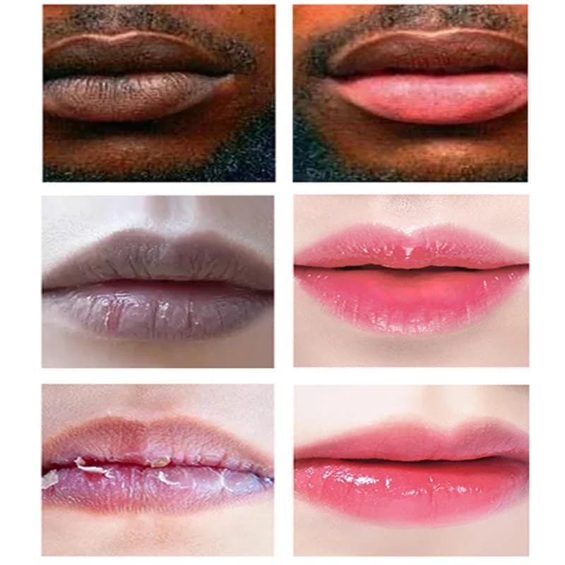 2PCS Lip Lightening Balm Dark Black Removal Exfoliation Pigmentation Fade Dull Pink Balm Anti-Crack Moisturizing Nourishing Lip Care Smokers Beauty and Personal Care Pozggoy