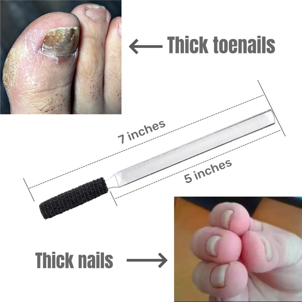 IDOU Toe Nail Files for Thick Nails,Stainless Steel 4 Sides 7 inch Length,Nail Files for Men Seniors & Dogs Beauty & Personal Care IDOU