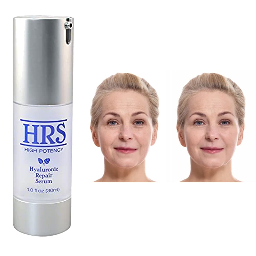 Hyaluronic Repair Concentrate High Potency by BioLogic Solutions (1 fl oz) Beauty & Personal Care Biologic Solutions
