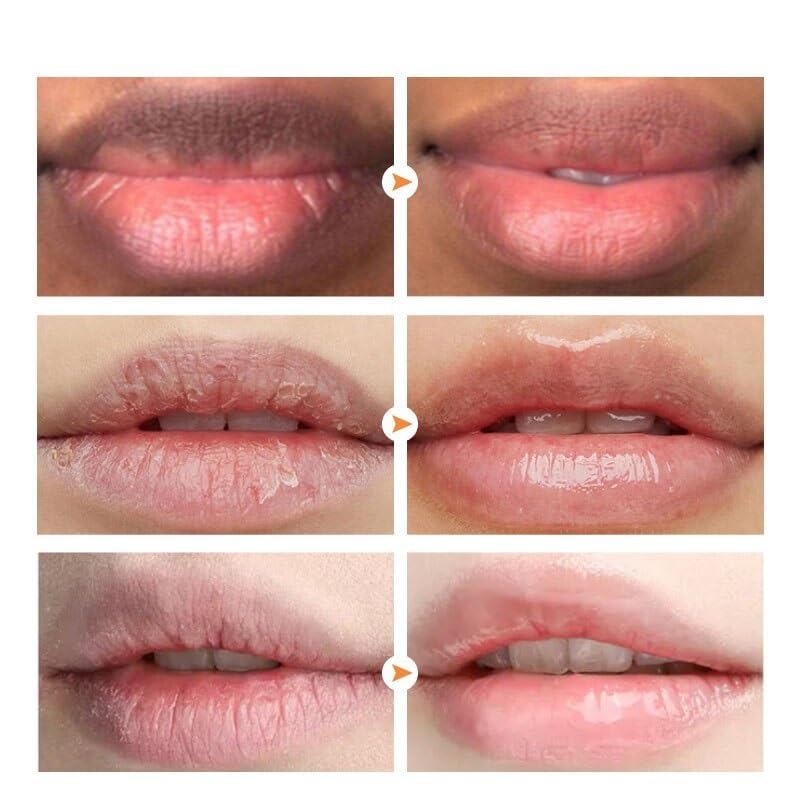 2PCS Lip Lightening for Dark Lips Lip for Smokers Dark Lip Treatment Lightening Cream for Pink Lips Lip Lightener for Smoker Lips Lip Lightening balm Beauty and Personal Care MSECVOI