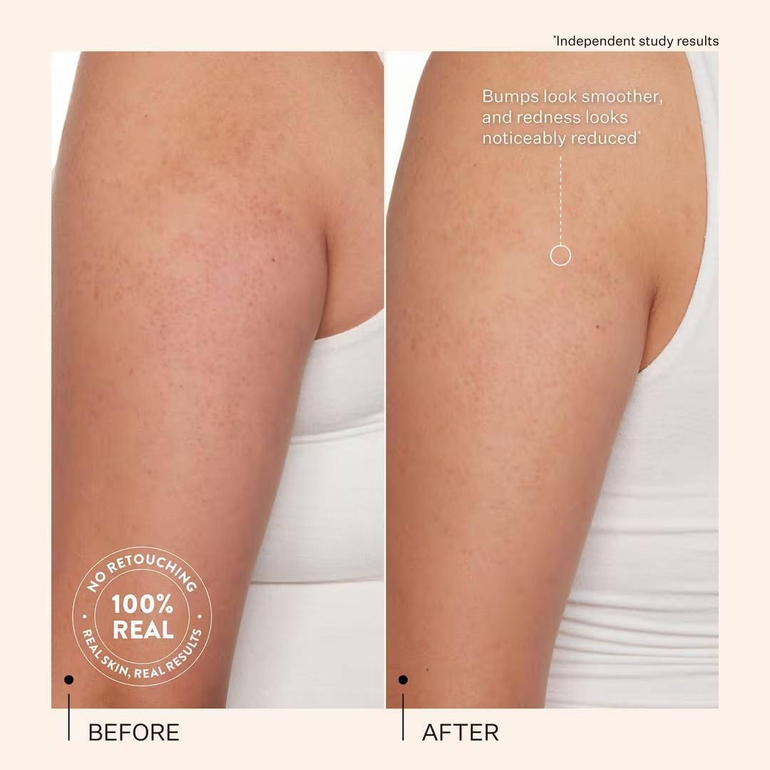 Peach & Lily KP Bump Boss Smoothing Body Lotion Beauty & Personal Care Peach & Lily