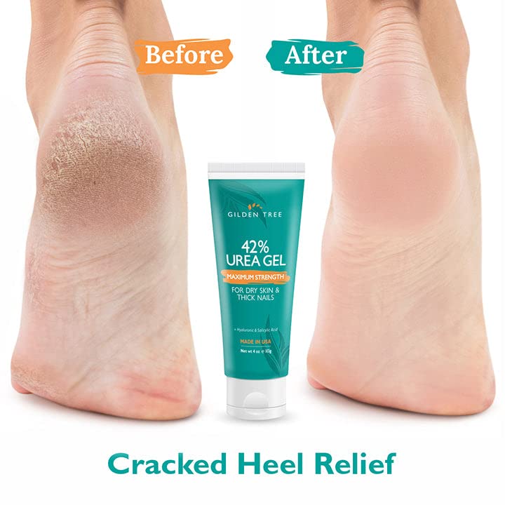 Urea Gel 42 Percent For Feet Maximum Strength Softens Cracked Heel Calluses & Thick Toenails Beauty & Personal Care GILDEN TREE