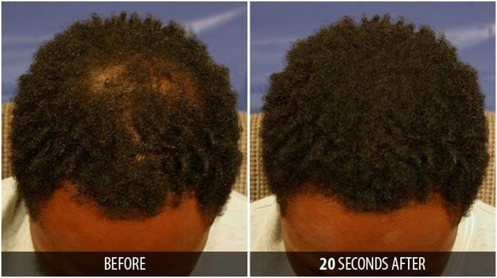 Dr. Yates MD Keratin Fiber Hair Enhancer (Dark Blonde) Beauty & Personal Care Dr. Yates MD hair + science