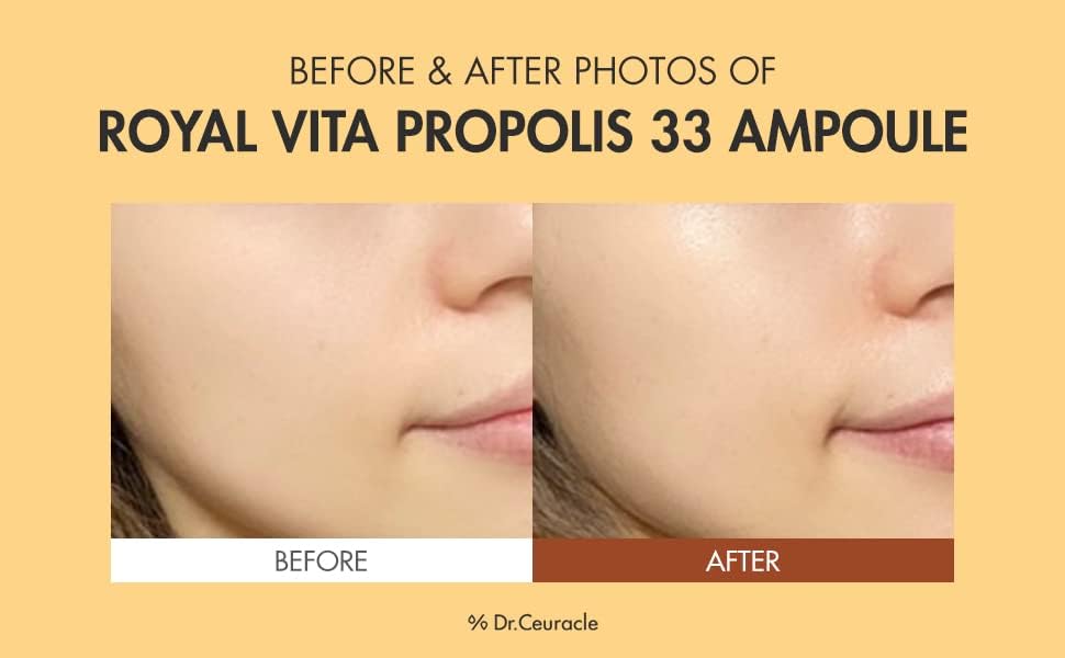 Dr.Ceuracle Royal Vita Propolis 33 Ampoule (30ml / 1.01 fl. oz.) - Ultimate Glow and Nourish Vitamin Serum for Radiant Skin, Formulated with Propolis Beauty & Personal Care Dr. Ceuracle