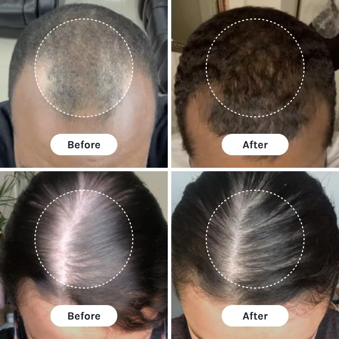 InfiniWell PTD-DBM Peptide Hair Serum for Fuller-Looking Hair - Scalp Treatment for Visible Growth & Follicle Renewal - Reinforce Restoration, Strand
