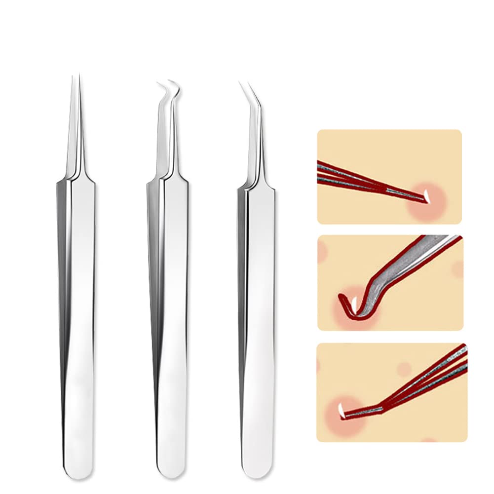 3 Pcs Stainless Steel Blackhead Splinter Remover Tweezers Blackhead Removal Needle Pointed Tweezers Ingrown Hair Tweezers Beauty and Personal Care UUYYEO