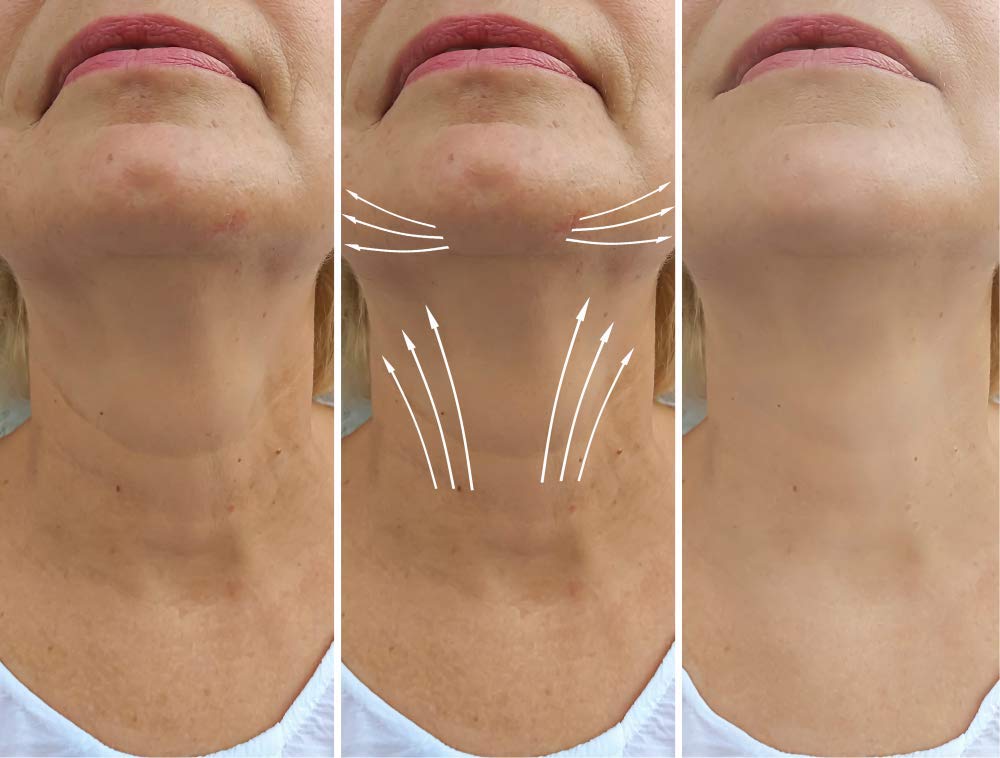 AminoGenesis N.E.C.K Control: Neck Lifting, Firming And Retracting Cream Beauty & Personal Care AminoGenesis