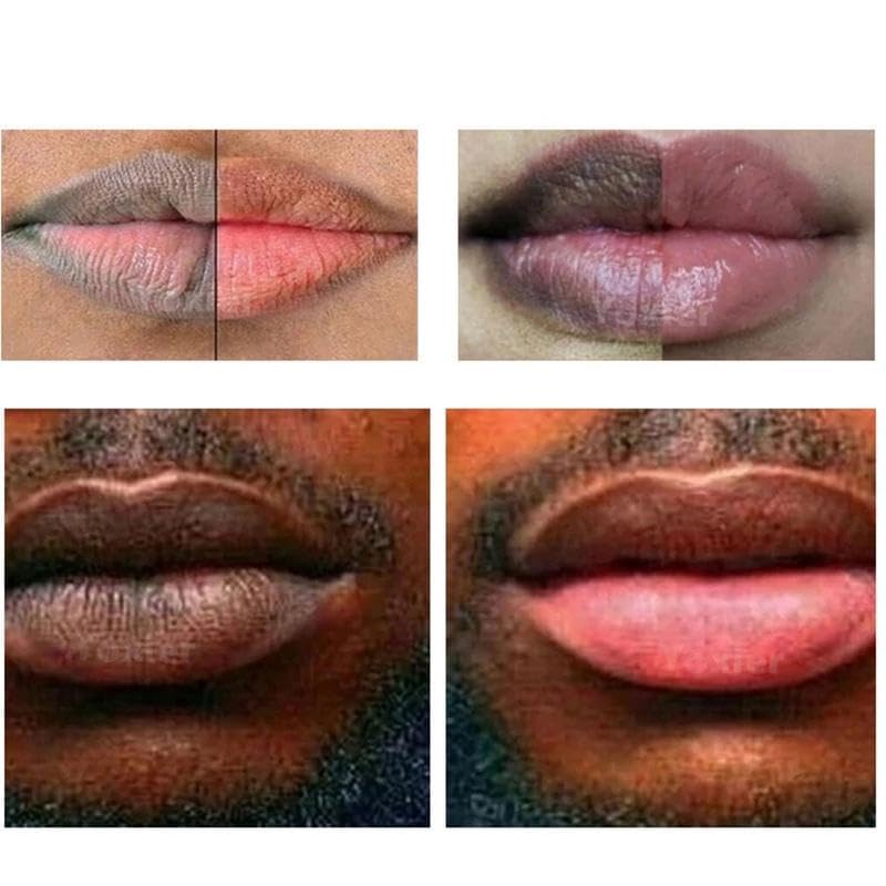 Lip Lightening for Dark Lips Lip Brightener for Smokers Dark Lip Treatment Lightening Cream for Pink Lips Lip Lightener for Smoker Lips Lip Lightening Beauty and Personal Care Rocet