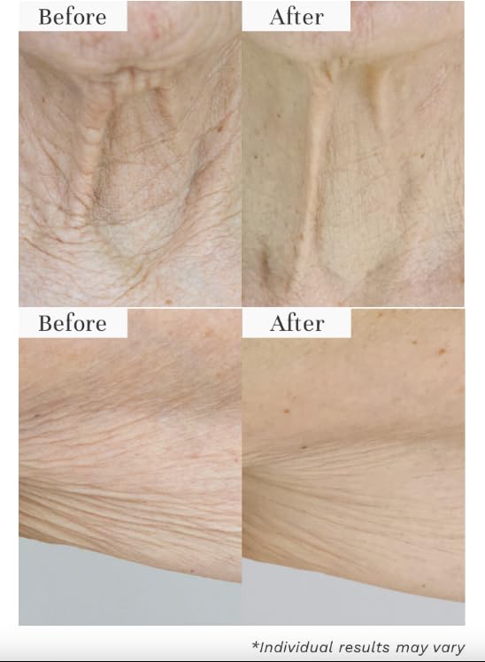City Beauty InvisiCrepe Body Balm - Skin Firming & Tightening Lotion for a Smoother, Firmer Look | Anti-Aging Firming Body Cream Beauty & Personal Care City Beauty