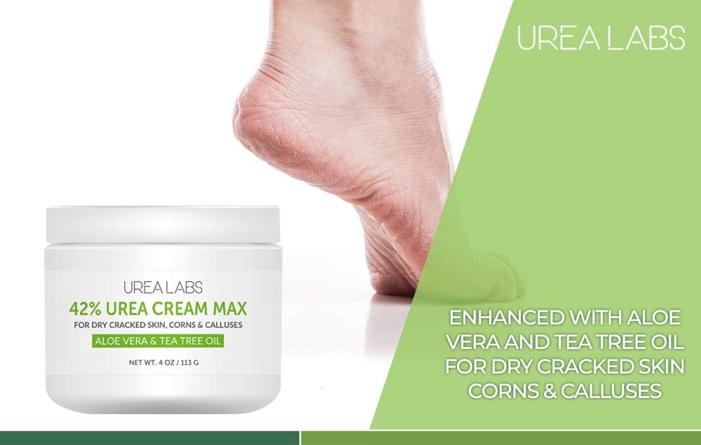 UREA LABS | 42% Urea Cream - Tea Tree Oil & Aloe Vera-Infused Foot & Skin Repair | Deep Hydration & Natural Exfoliation for Cracked Heels, Dry Feet Beauty & Personal Care UREA LABS