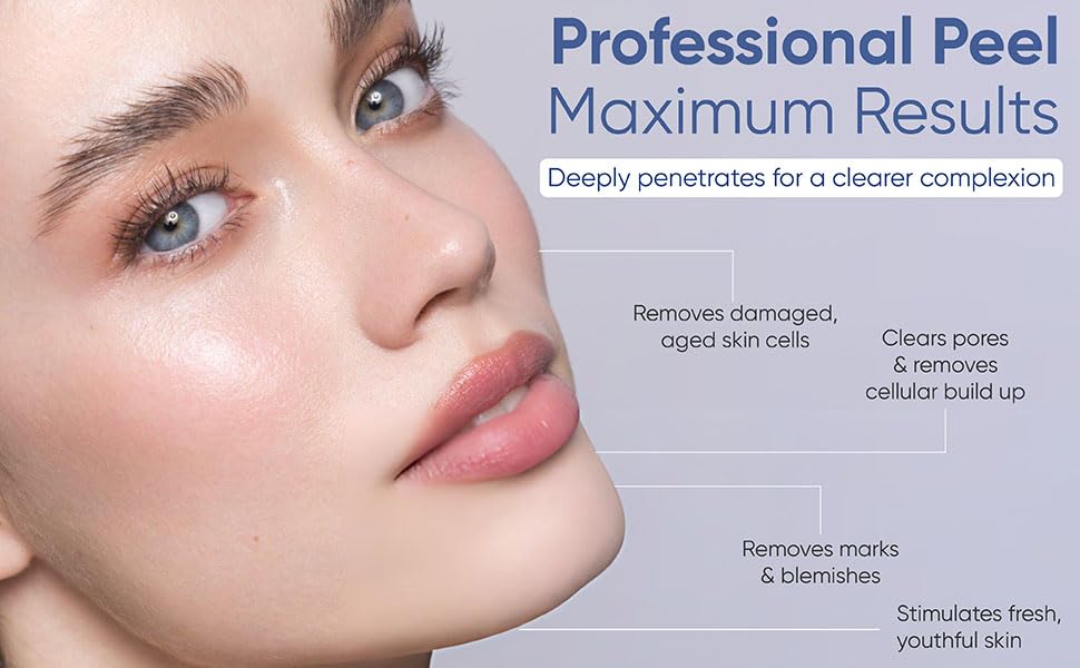 SKIN PEEL 4000 - Chemical Skin Peel Kit | Created in1937 | Gets rid of acne scars, blemishes, large pores, fine lines, sun damage in only 6 days! Beauty & Personal Care SKIN CULTURE