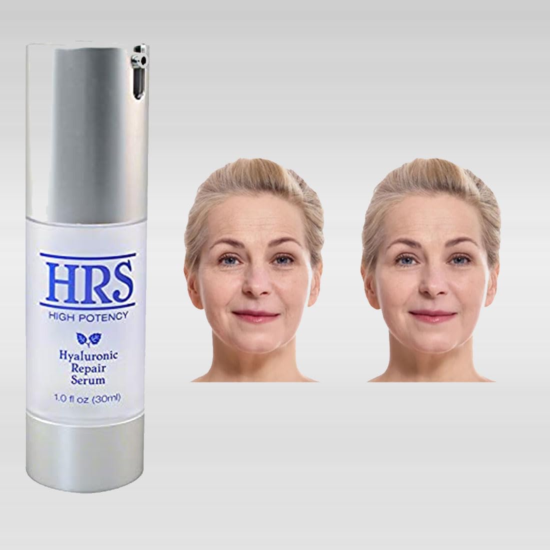 Hyaluronic Repair Concentrate High Potency by BioLogic Solutions (1 fl oz) Beauty & Personal Care Biologic Solutions