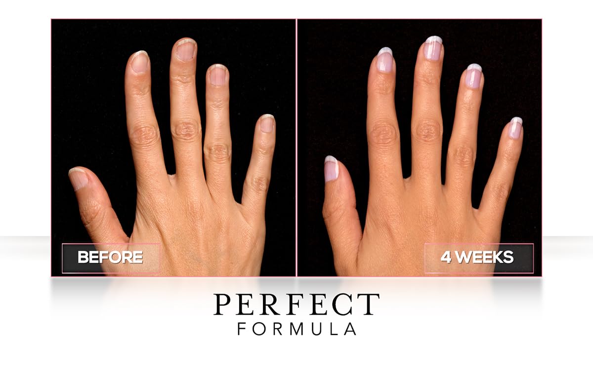 Perfect Formula Daily Moisture Treatment, 0.5 Fl Oz Beauty & Personal Care Perfect Formula