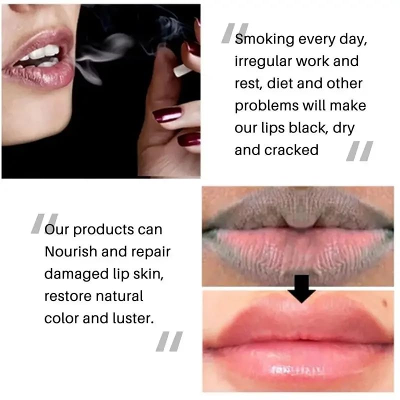 2PCS Lip Lightening for Dark Lips Lip for Smokers Dark Lip Treatment Lightening Cream for Pink Lips Lip Lightener for Smoker Lips Lip Lightening balm Beauty and Personal Care MSECVOI