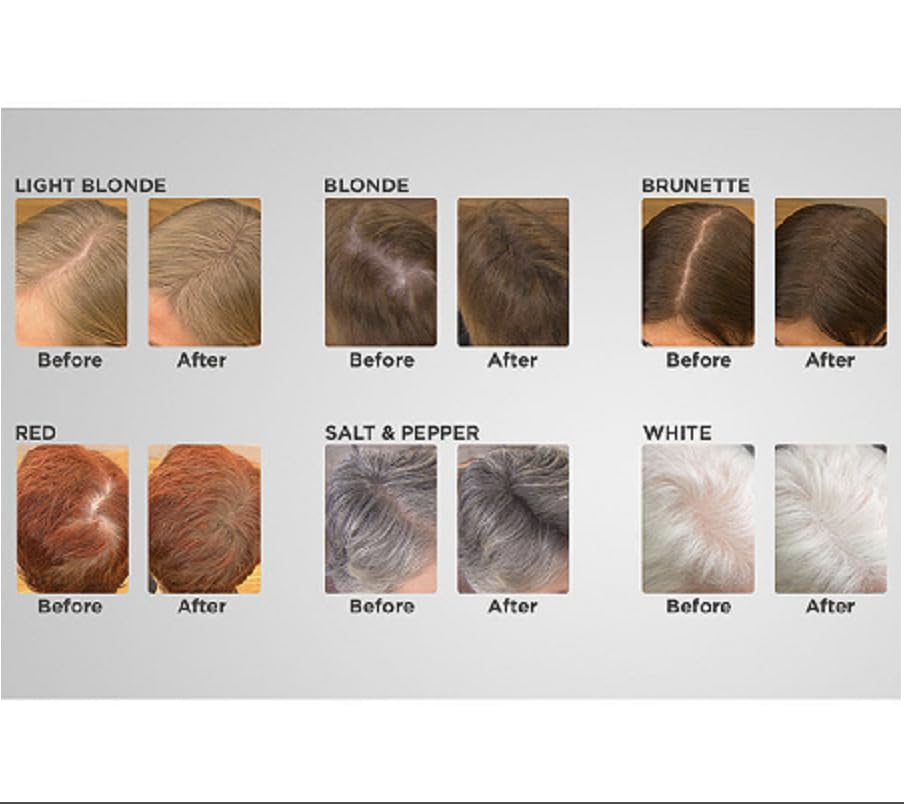 Joan Rivers Beauty Great Hair Day Fill-in Powder Hair Care Root Cover Up for Thinning Hair - White Beauty & Personal Care Joan Rivers Beauty