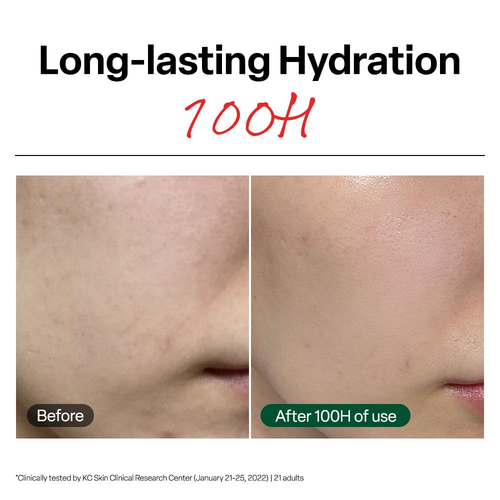 Dr. G R.E.D. Blemish Clear Soothing Cream - Calming Korean Moisturizer for Redness - Soothes Acne & Irritation - With Centella Asiatica - Long-Lasting Beauty & Personal Care Dr.G
