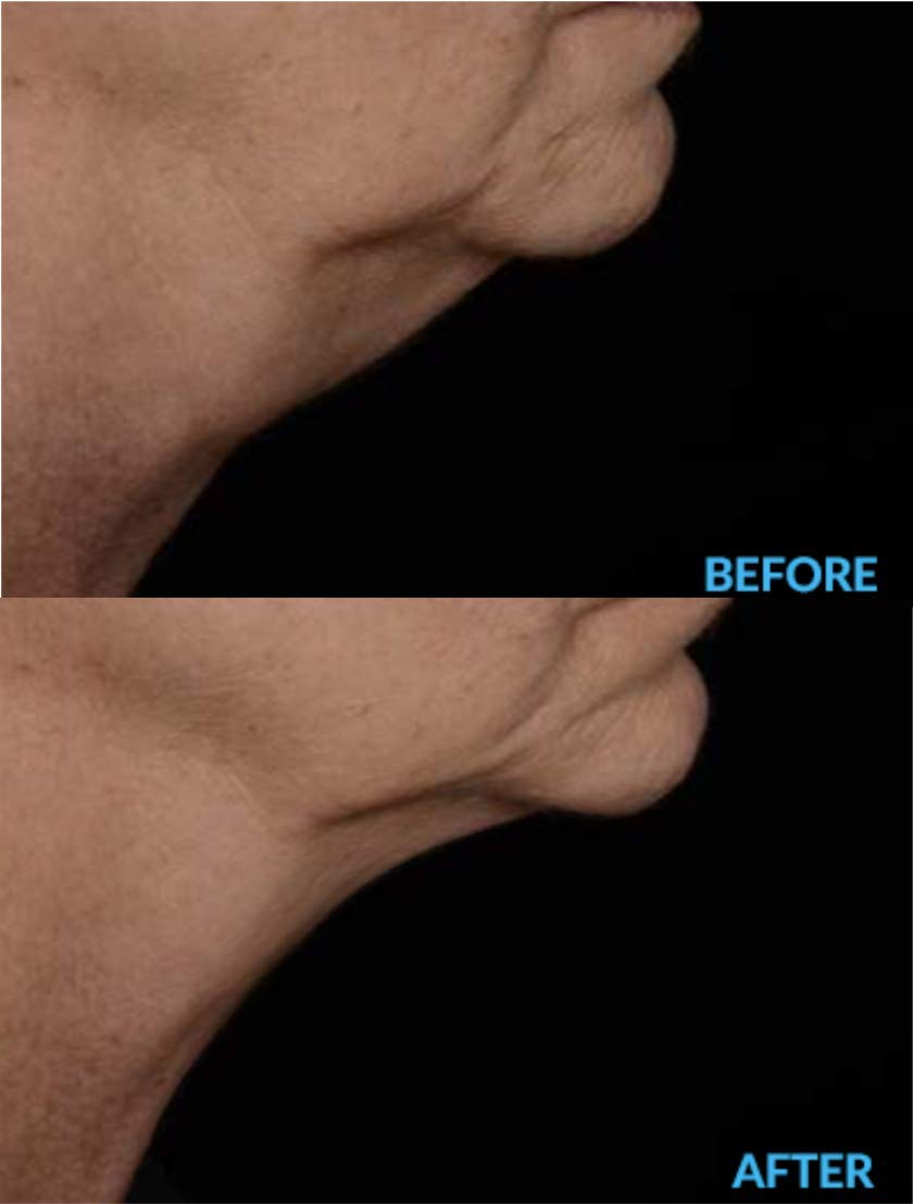 AminoGenesis N.E.C.K Control: Neck Lifting, Firming And Retracting Cream Beauty & Personal Care AminoGenesis