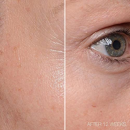 MD Complete Total Eye Treatment | Anti-Aging Hydrating Skin Renewal Eye Treatment | with Peptides, Vitamins C & E and Hyaluronic Acid for Wrinkles Beauty & Personal Care MD Complete by Dr. Brian Zelickson