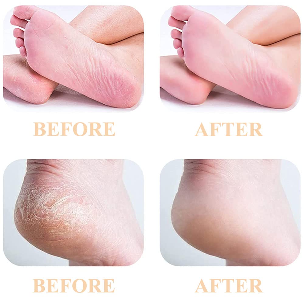 PAI4LEISI 6 Coarse Pedicures Replacement Heads for Flawless Pedi Electric Tool Foot File,Pedi Replacement Roller Head fit Finishing Touch Flawless Beauty & Personal Care P4L