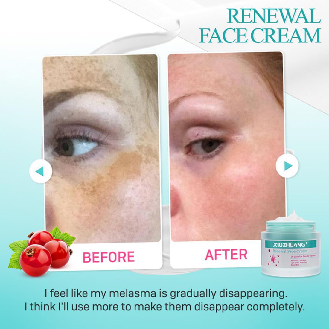 XIUZHUANG Gentle Non-irritating moisturizer face cream for Women - Treats Melasma freckles Dark Spots Shrinks pores Nourishing Facial Care-1.46 fl oz Beauty & Personal Care XIUZHUANG