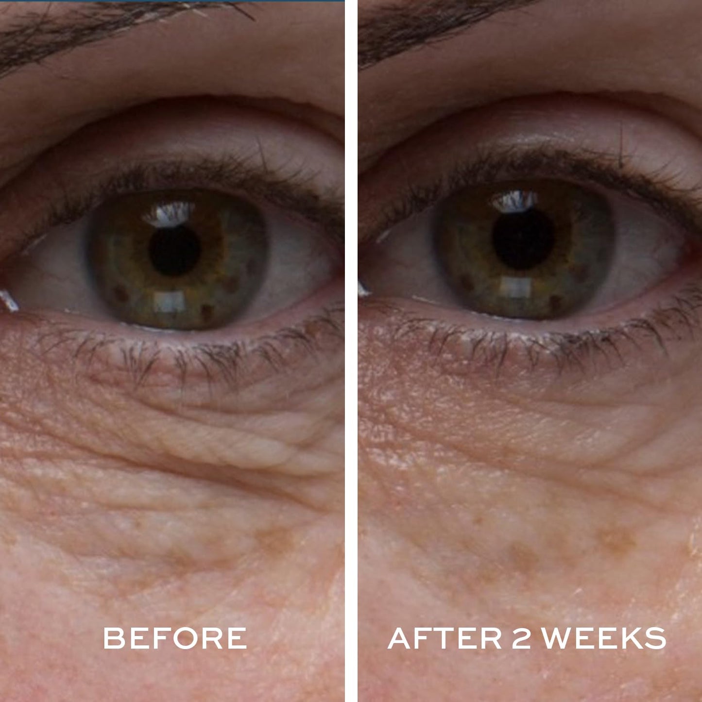 ELEMIS Peptide4 Eye Recovery Cream, Reviving Eye Cream, 0.5 Fl Oz Beauty & Personal Care ELEMIS