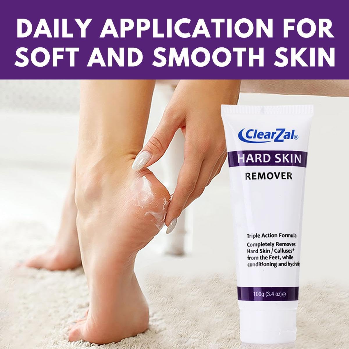 Clearzal Foot Cream For Hard Skin, Helps Calluses and Corn Removal While Leaving Soft Smooth Skin, Hydrating and Conditioning Triple Action Formula Beauty & Personal Care Clearzal