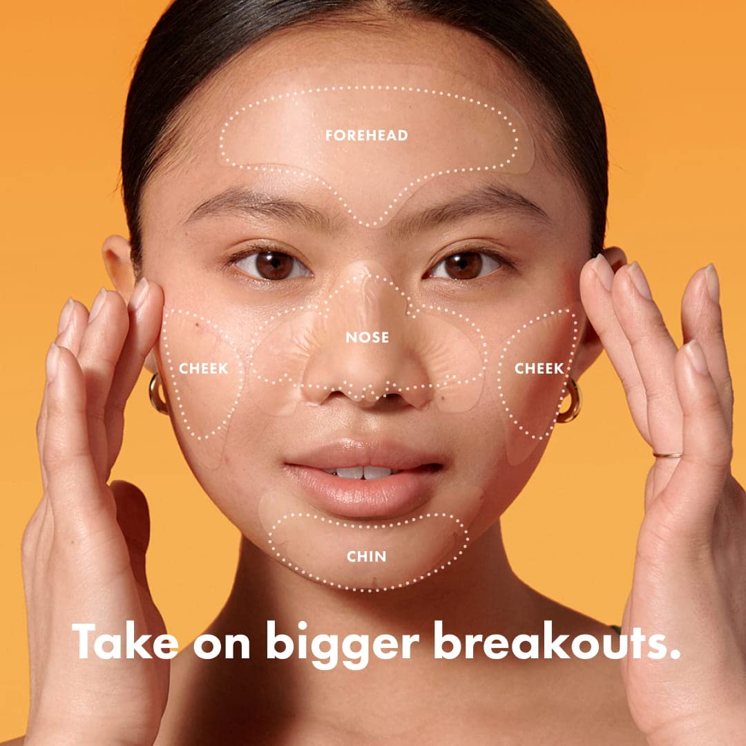 Hero Cosmetics Mighty Patch™ Face Patch - XL Hydrocolloid Face Mask for Acne, 5 Large Pimple Patches for Zit Breakouts on Nose, Chin, Forehead Beauty & Personal Care Mighty Patch